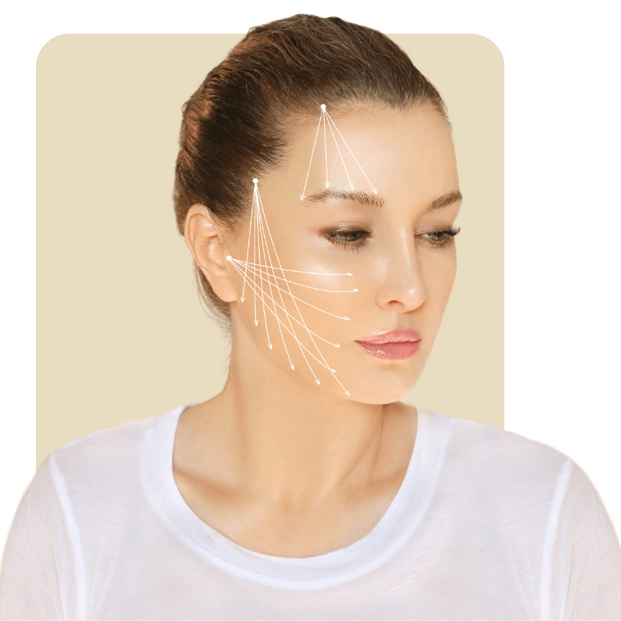 Threadlift procedure