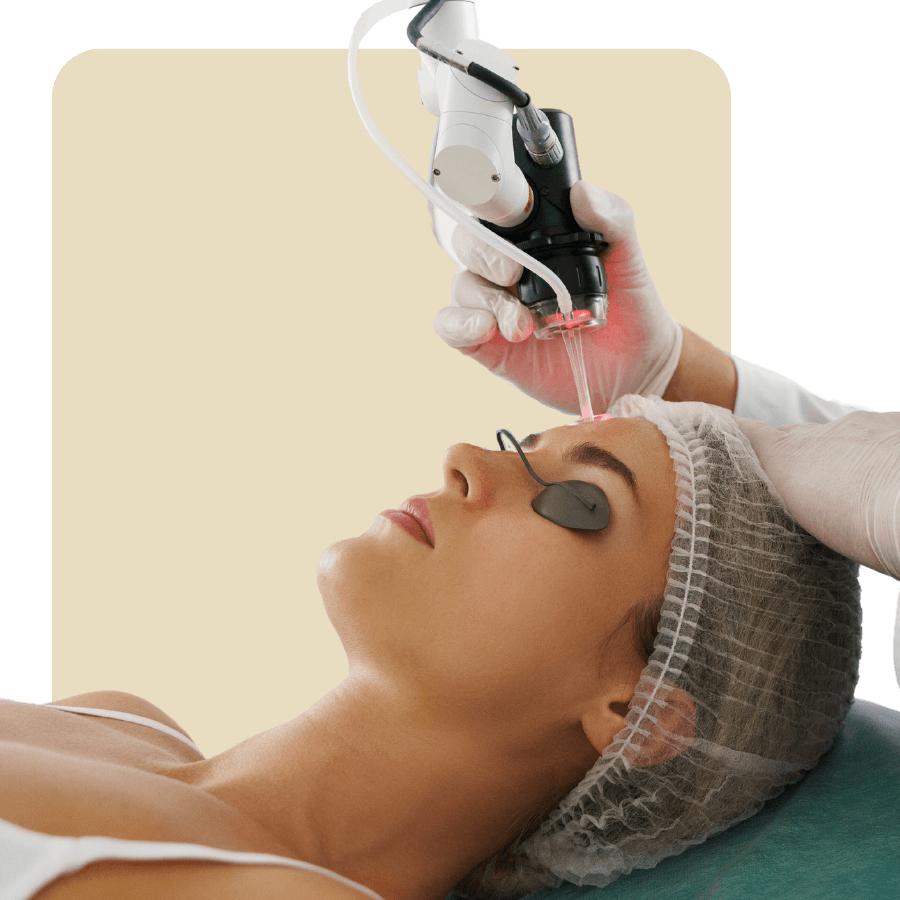 Laser skin rejuvenation